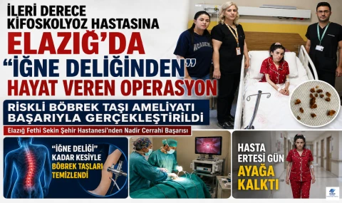Riskli Böbrek Taşı Ameliyatı Başarıyla Gerçekleştirildi Elazığ Fethi Sekin Şehir Hastanesi'nden Nadir Cerrahi Başarısı